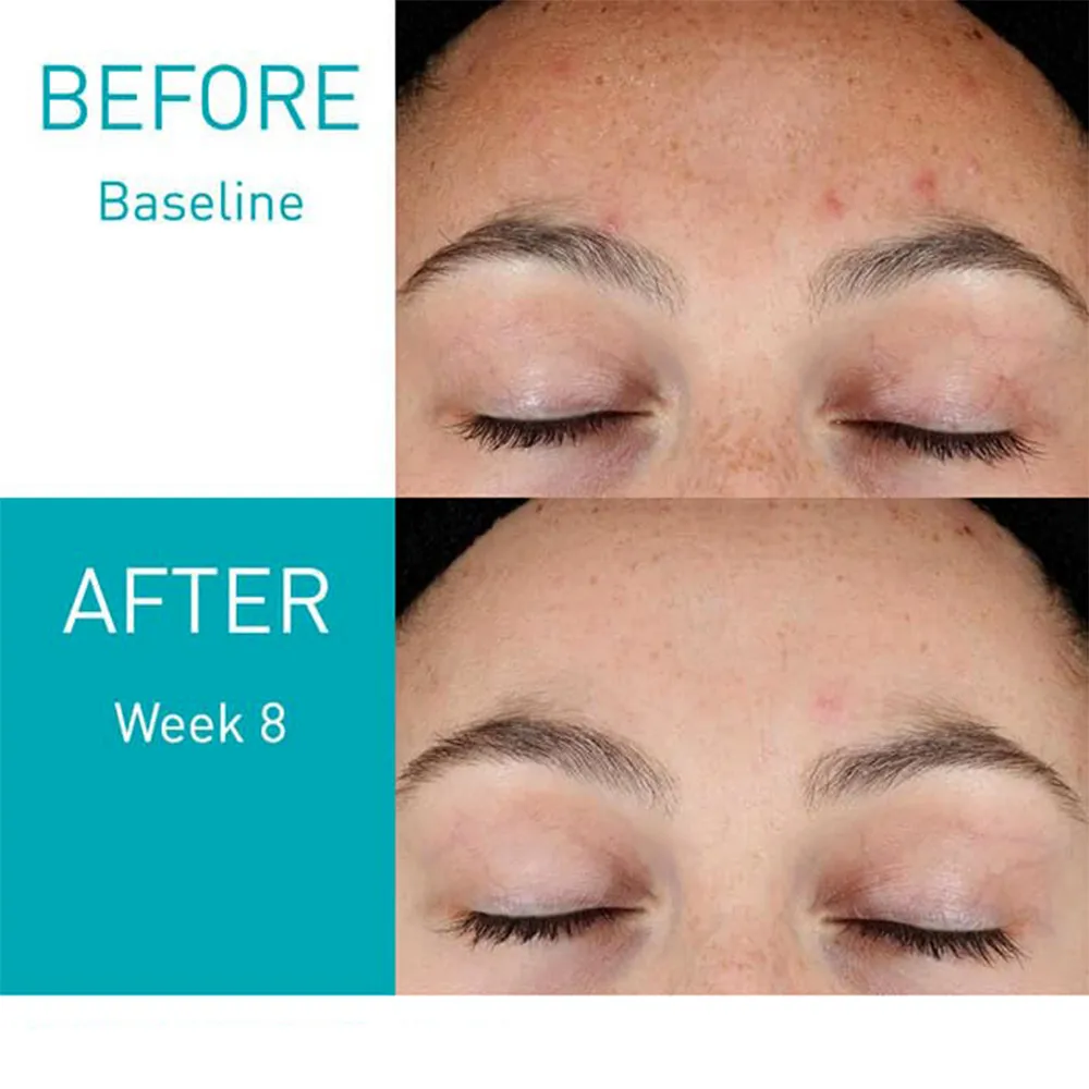 سرم رتینول سراوی حاوی نیاسینامید و سرامید بازسازی کننده پوست CeraVe Resurfacing Retinol Serum with Ceramides Niacinamide for Blemish Prone Skin 30ml 4