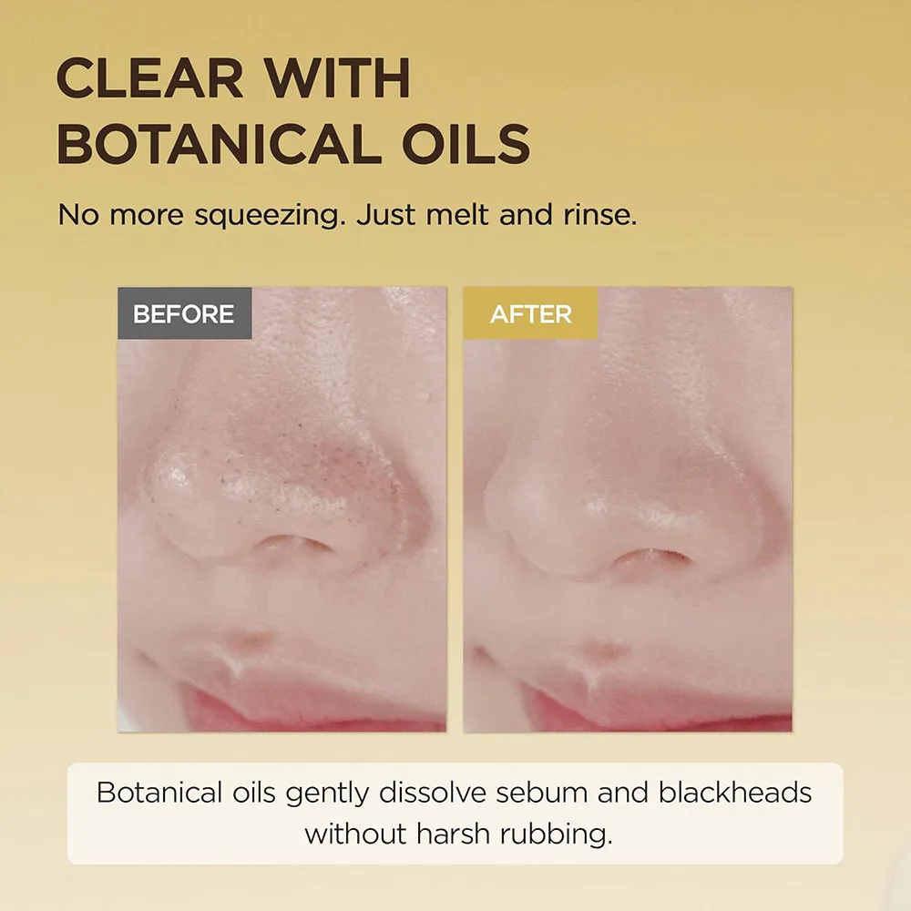 شوینده روغنی سبک سنتلا ماداگاسکار اسکین ۱۰۰۴ SKIN1004 Madagascar Centella Light Cleansing Oil