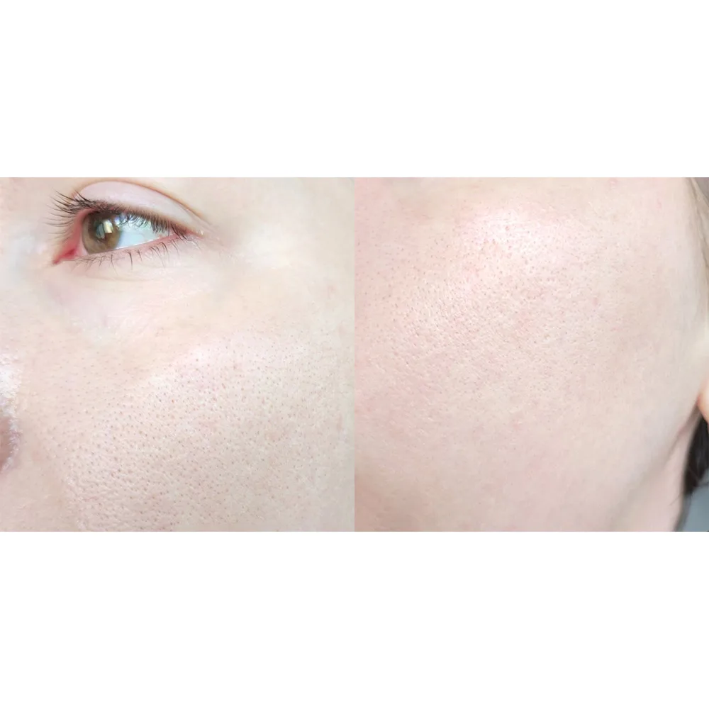 ژل شستشوی گود مورنینگ کوزارکس PH پایین