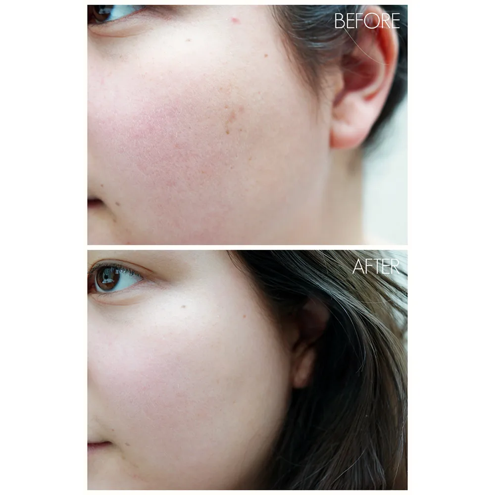 تونر لایه‌بردار و شفاف‌کننده AHA/BHA کوزارکس در سایت «بانو»