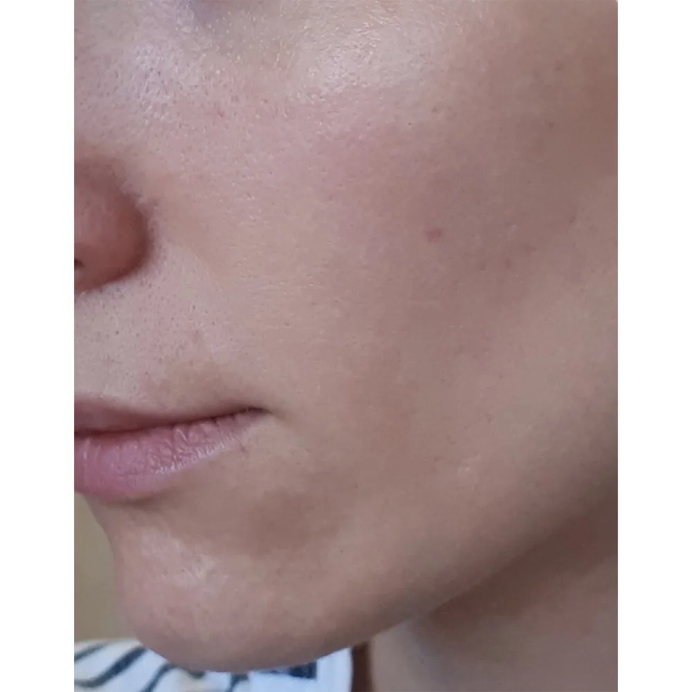 ژل کرم چای سبز آبرسان و تسکین دهنده کوزارکس