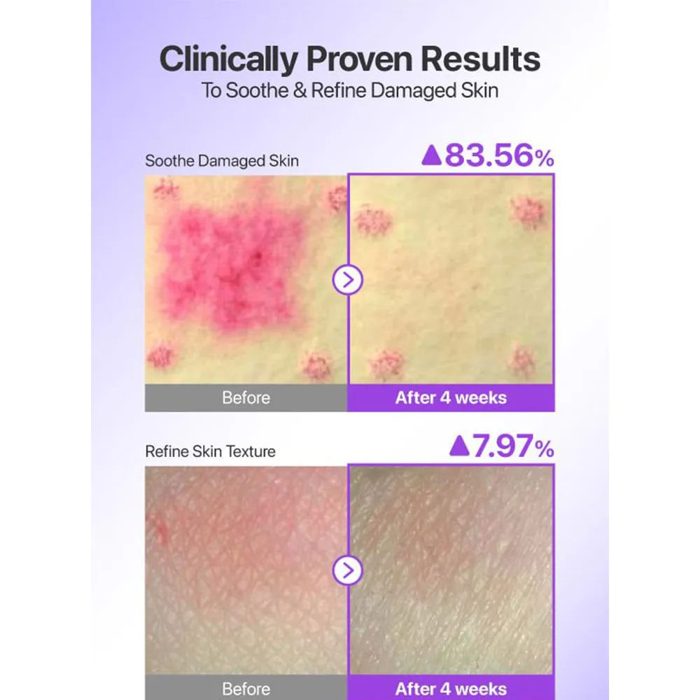 “اسنس ضد آفتاب نامبوزین شماره 9 با NAD و پپتید SPF55+ PA++++ ضد چروک و جوان‌سازی با بافت سبک و جلوه شیشه‌ای محصول اصل کره‌ای”