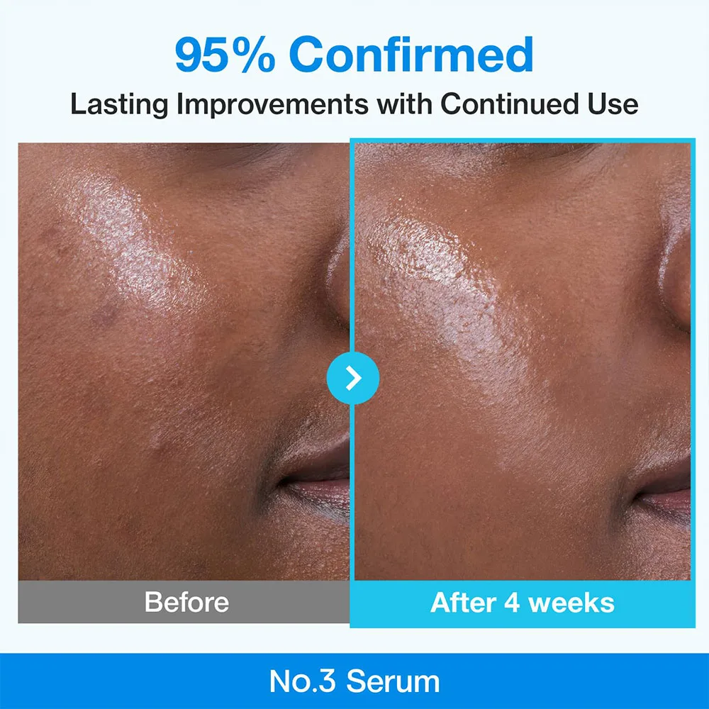 “سرم بایو رتینول آبی نامبوزین شماره W کوچک‌کننده منافذ پوست و بهبود دهنده بافت با 10% نیاسینامید محصول اصل کره‌ای”