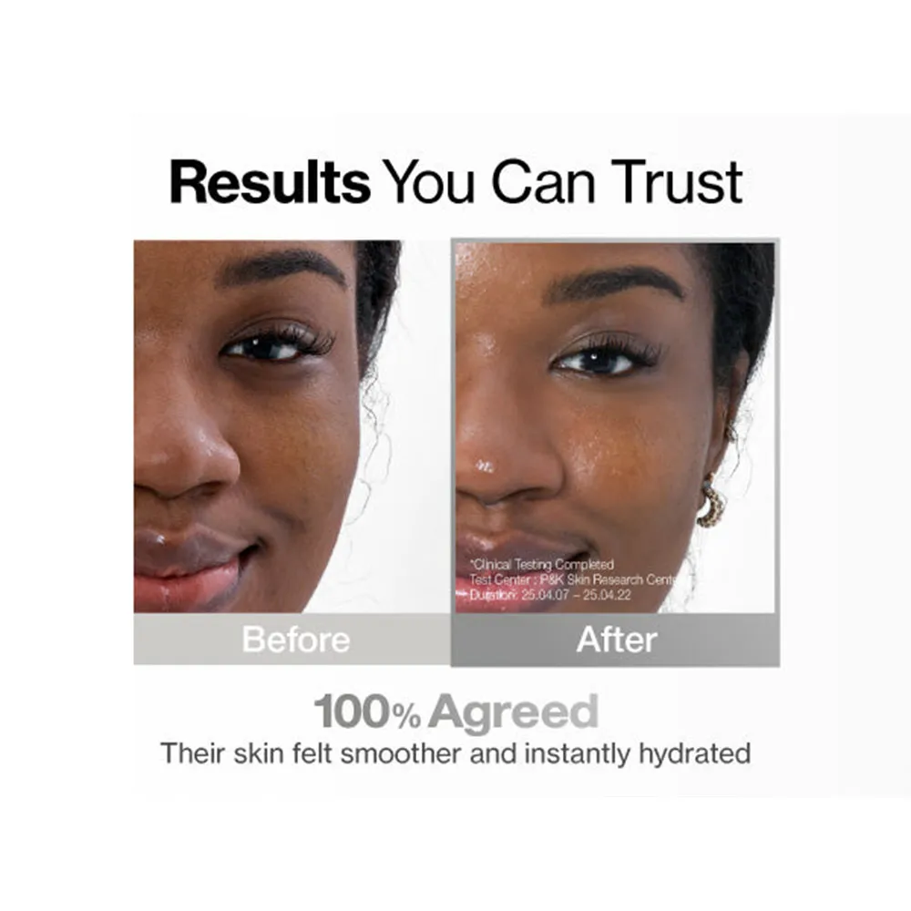 سرم لایه بردار و آبرسان سراماید شماره 4 نامبوزین مدل Glazed Skin Prep اصل