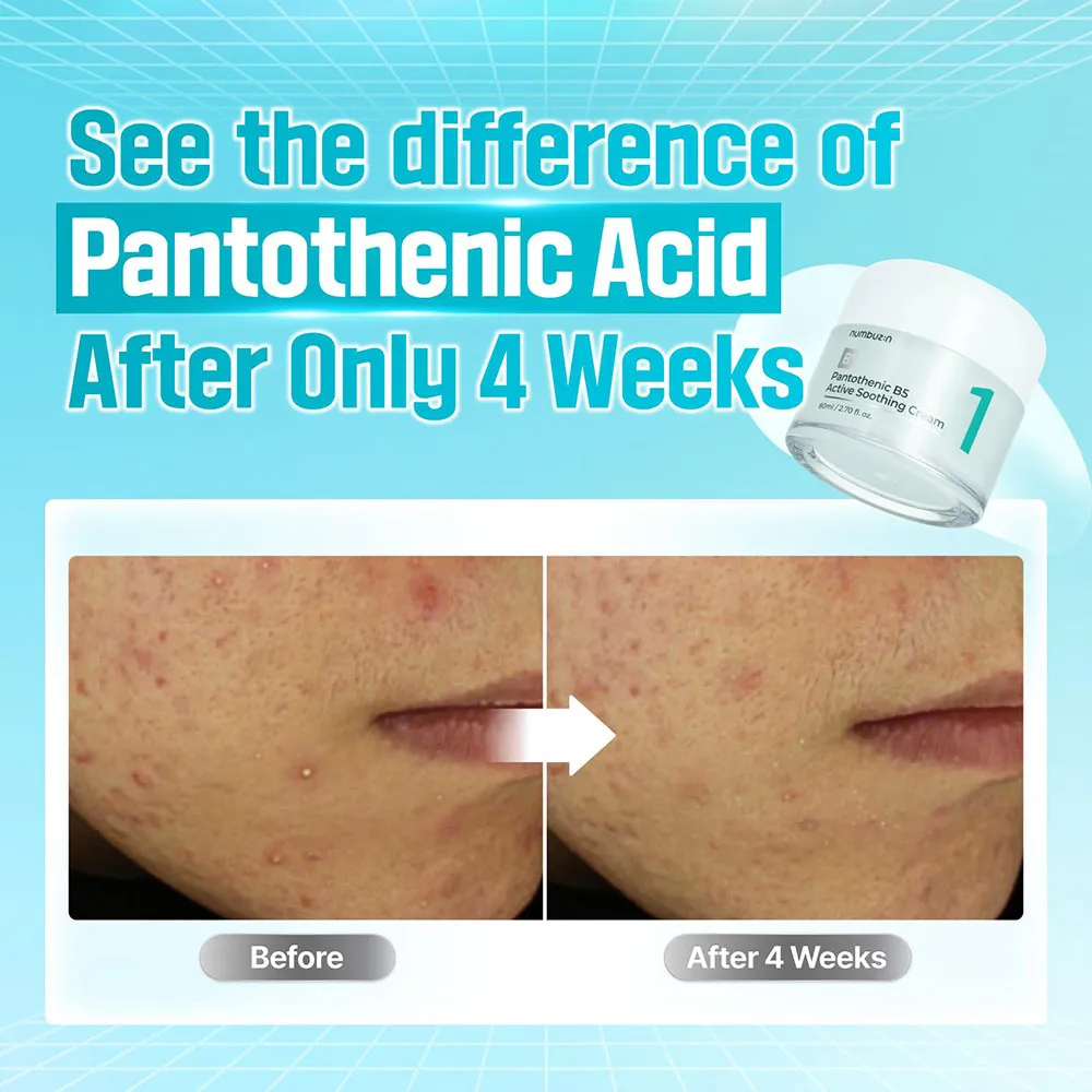 کرم مرطوب کننده و تسکین دهنده پوست حاوی B5 شماره 1 نامبوزین اصل مدل Pantothenic Active Soothing Cream