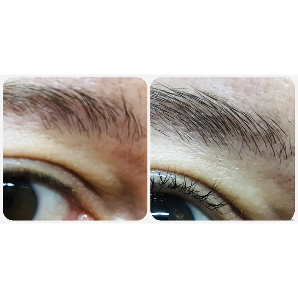 عکس سرم تقویت کننده مژه و ابرو مولتی پپتید اوردینری اصل برای رشد سریع، پرپشتی و ضخامت