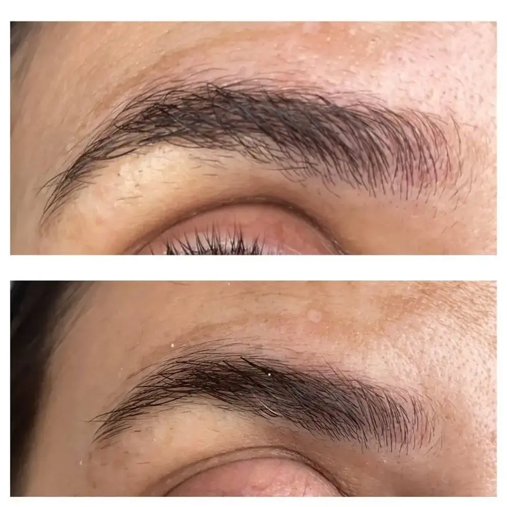 عکس سرم تقویت کننده مژه و ابرو مولتی پپتید اوردینری اصل برای رشد سریع، پرپشتی و ضخامت