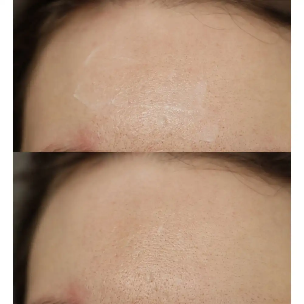 کرم آبرسان و مرطوب‌کننده اوردینری Natural Moisturizing Factors اصل؛ بهترین انتخاب برای آبرسانی سبک و تقویت سد دفاعی پوست.
