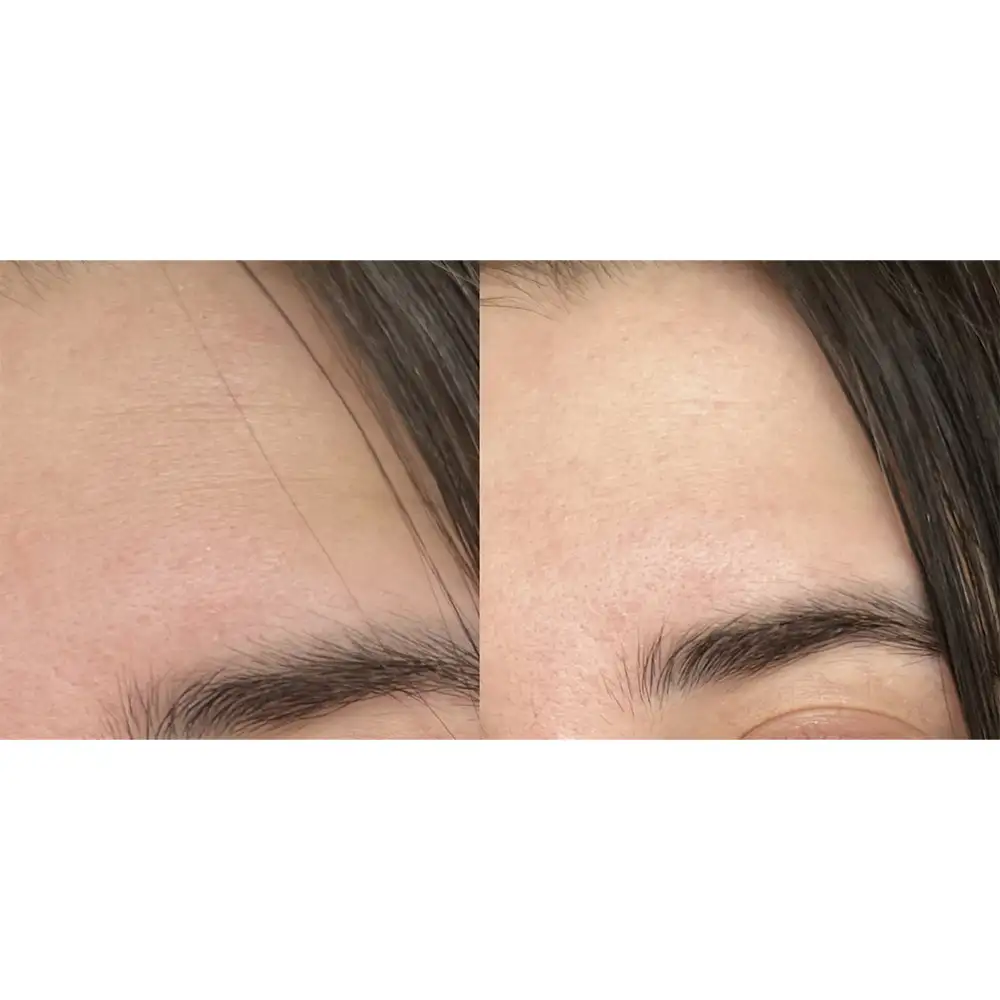 کرم آبرسان و مرطوب‌کننده اوردینری Natural Moisturizing Factors اصل؛ بهترین انتخاب برای آبرسانی سبک و تقویت سد دفاعی پوست.