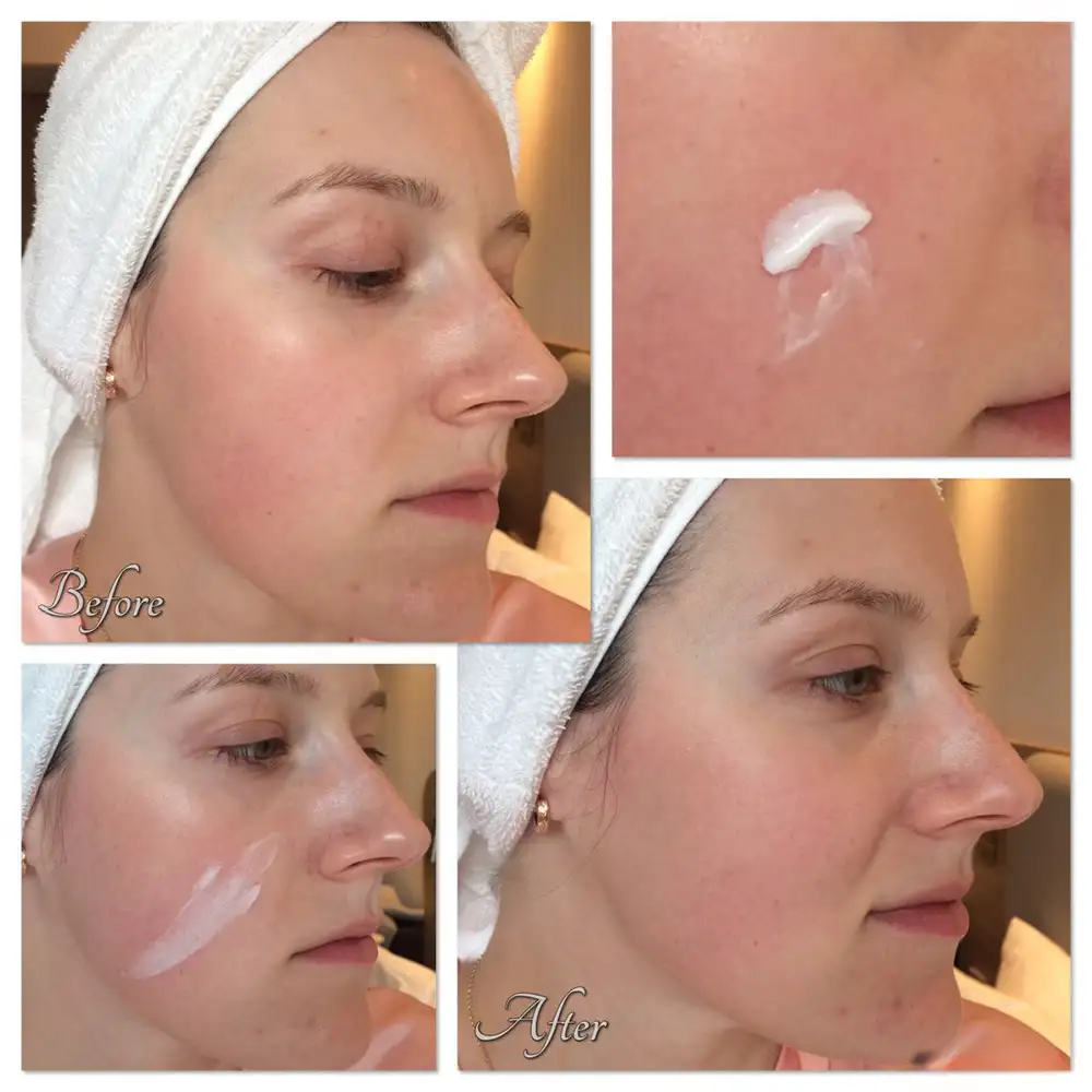 کرم آبرسان و مرطوب‌کننده اوردینری Natural Moisturizing Factors اصل؛ بهترین انتخاب برای آبرسانی سبک و تقویت سد دفاعی پوست.