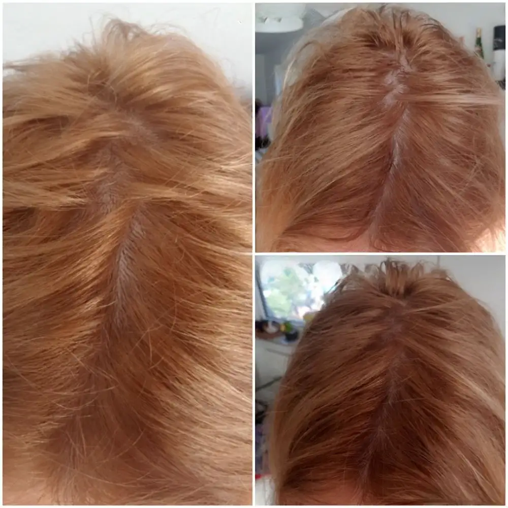 سرم ضد ریزش و پرپشت کننده مو اوردینری Multi Peptide اصل؛ راهکار تخصصی برای افزایش تراکم و تقویت ریشه موها.