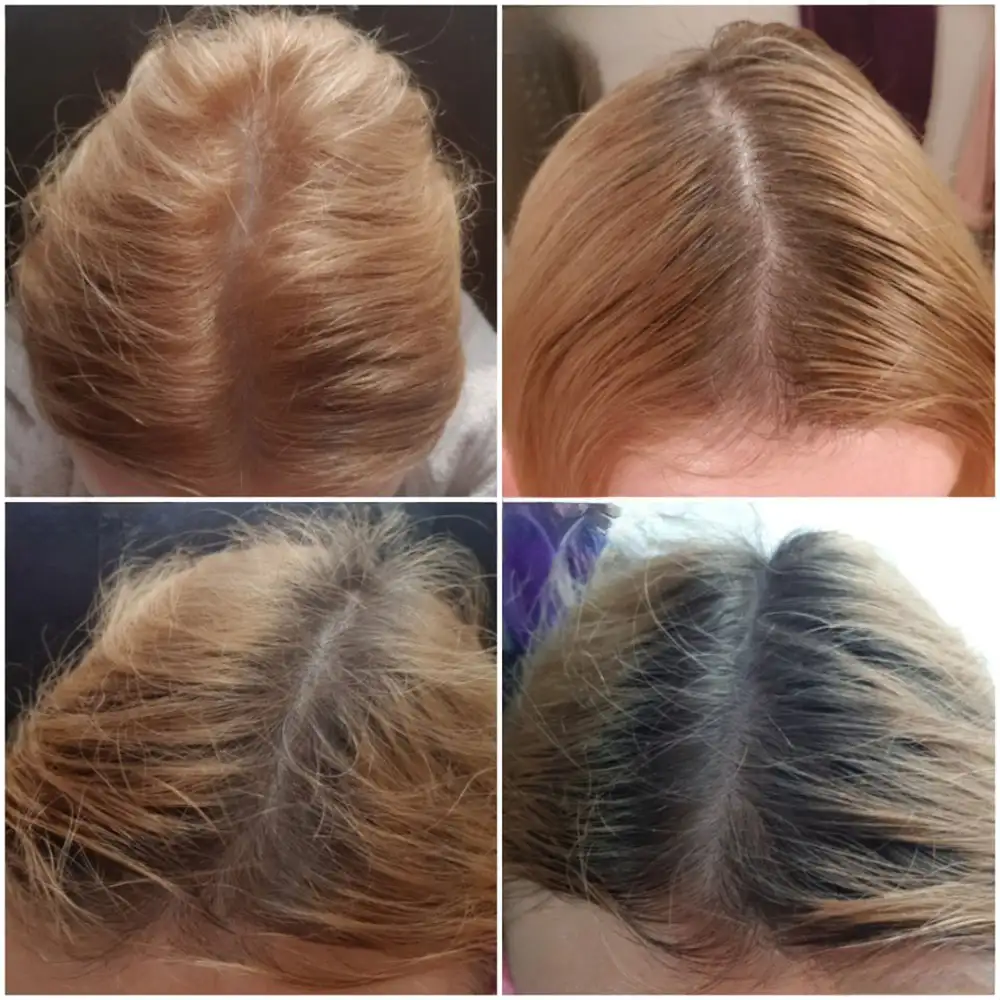 سرم ضد ریزش و پرپشت کننده مو اوردینری Multi Peptide اصل؛ راهکار تخصصی برای افزایش تراکم و تقویت ریشه موها.