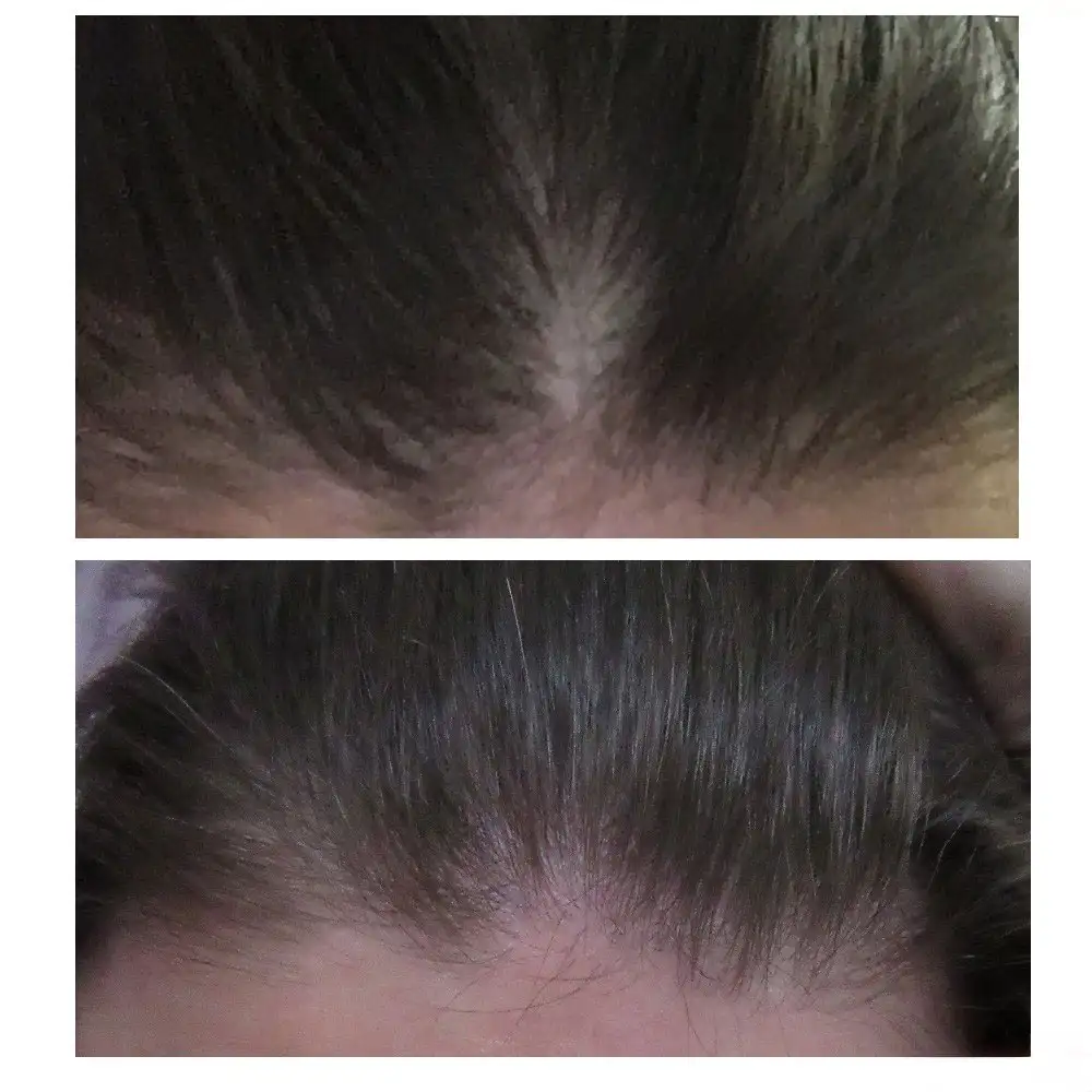 سرم ضد ریزش و پرپشت کننده مو اوردینری Multi Peptide اصل؛ راهکار تخصصی برای افزایش تراکم و تقویت ریشه موها.