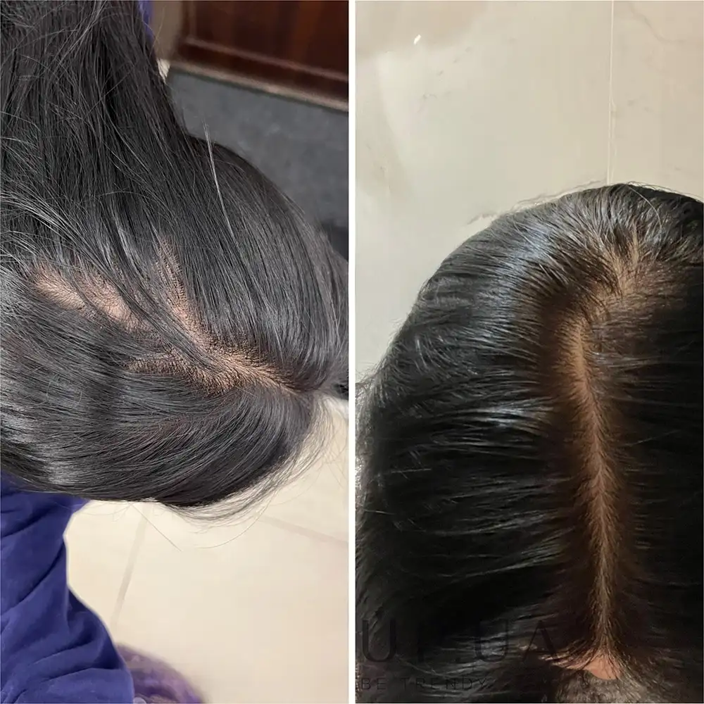 سرم ضد ریزش و پرپشت کننده مو اوردینری Multi Peptide اصل؛ راهکار تخصصی برای افزایش تراکم و تقویت ریشه موها.