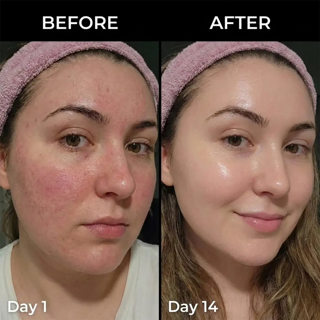 pdrn medicube pdrn pink collagen volume multi balm image 2
