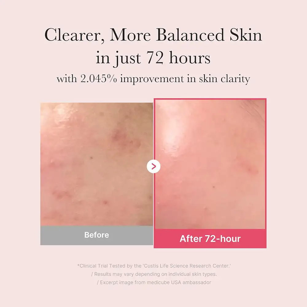 سرم ضد لک و روشن کننده ترانگزامیک اسید و نیاسینامید مدی کیوب اصل مدل MEDICUBE TXA Niacinamide 10% Serum مناسب کاهش لک، روشن شدن پوست و بهبود بافت