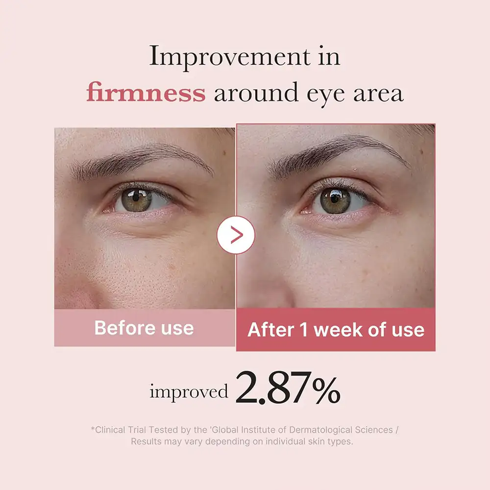 کرم دور چشم PDRN و پپتاید مدی کیوب اصل مدل Medicube PDRN Pink Peptide Eye Cream مناسب کاهش چروک دور چشم، روشن شدن تیرگی، آبرسانی و بهبود بافت اطراف چشم