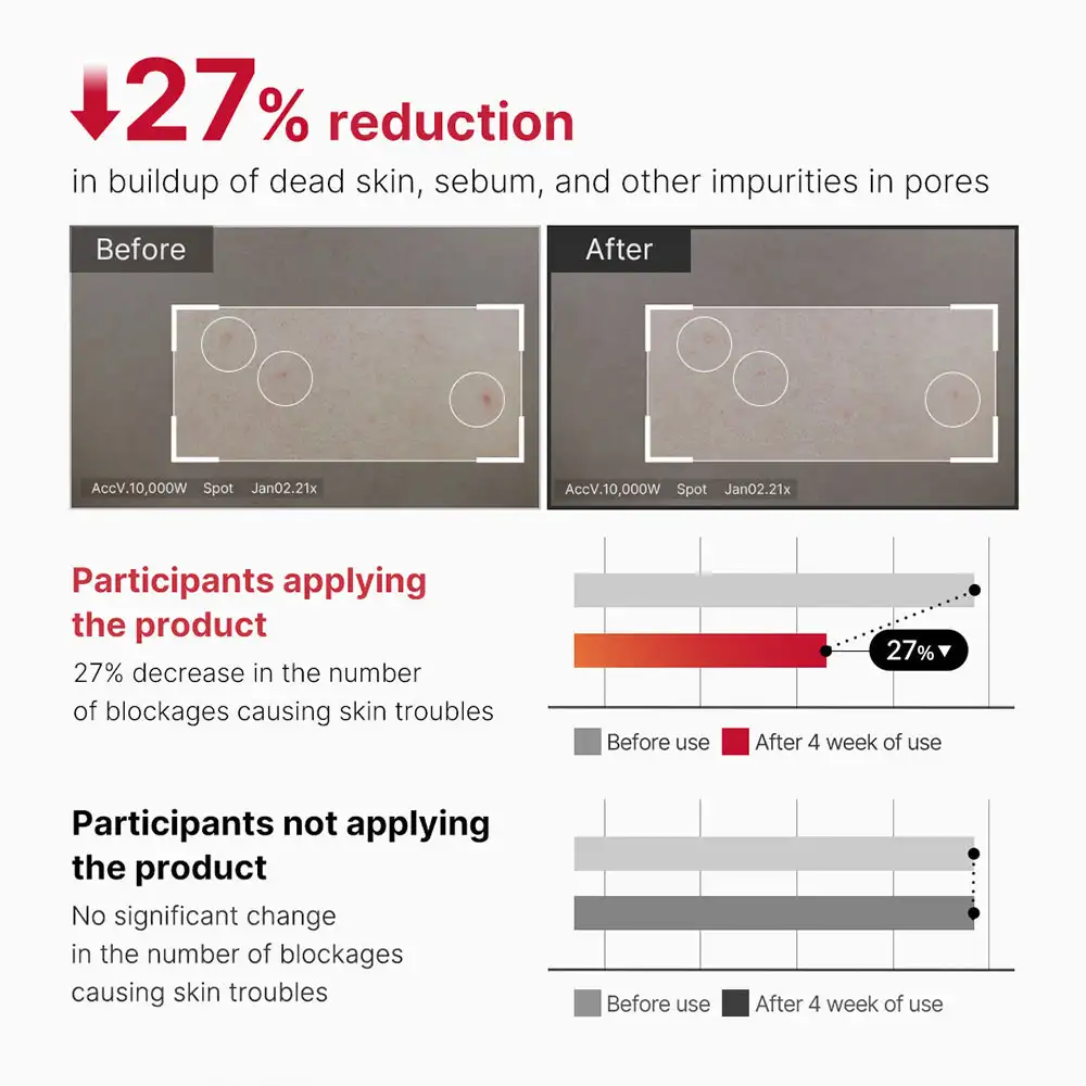اسپری لایه بردار و ضد جوش بدن مدی کیوب اصل مدل Medicube Red Acne Body Peeling Shot مناسب کاهش جوش بدن، زبری پوست، استرابری اسکین، پاکسازی منافذ و صاف شدن پوست بدن