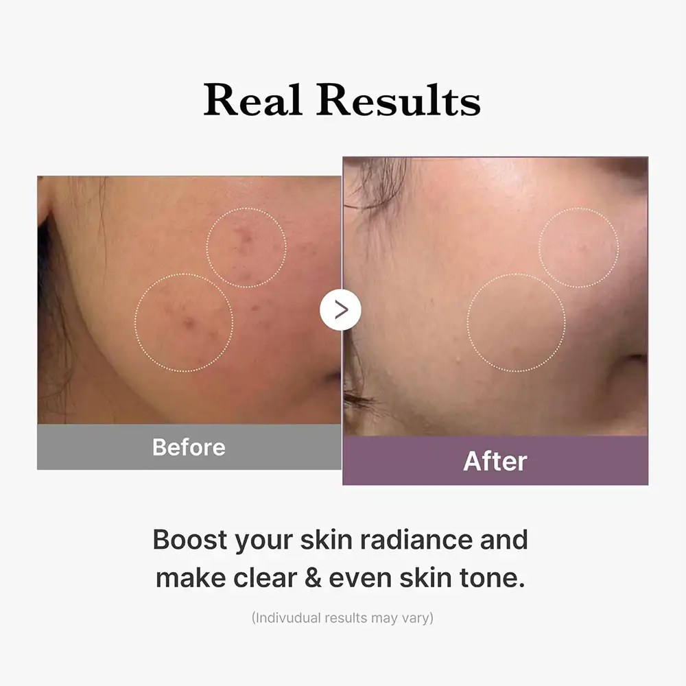 تونر گلوتاتیون مدی کیوب اصل مدل Medicube Age R Glutathione Glow Milky Toner مناسب روشن شدن پوست، آبرسانی، افزایش شفافیت، یکنواخت شدن رنگ پوست و ایجاد گلس اسکین