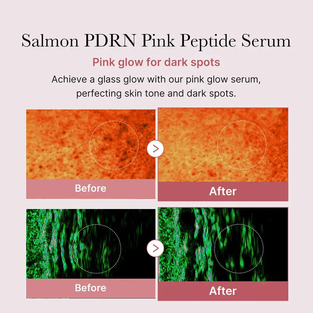 سرم صورتی روشن‌کننده پپتاید و PDRN مدی کیوب اصل مدل Medicube PDRN Pink Peptide Serum مناسب شفافیت، آبرسانی، تقویت سد دفاعی، بهبود تناژ ناهموار و افزایش استحکام پوست