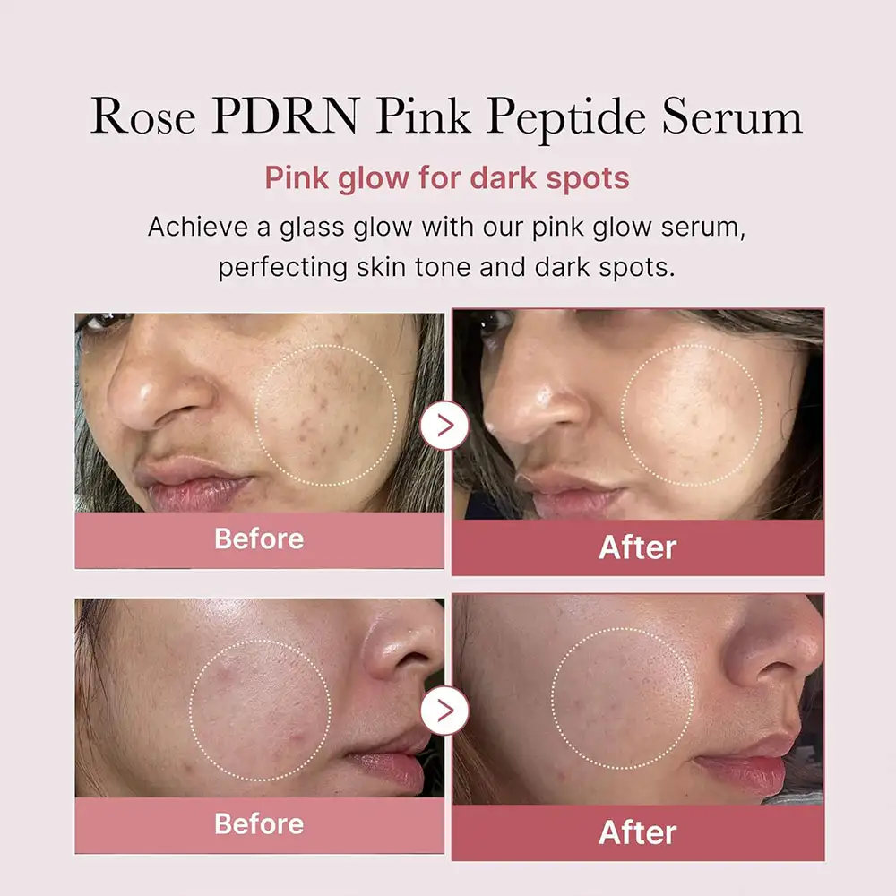 سرم صورتی روشن‌کننده پپتاید و PDRN مدی کیوب اصل مدل Medicube PDRN Pink Peptide Serum مناسب شفافیت، آبرسانی، تقویت سد دفاعی، بهبود تناژ ناهموار و افزایش استحکام پوست