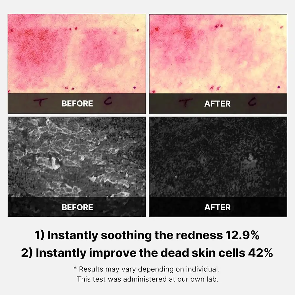 پد تونر سوپر سیکا مدی کیوب اصل مدل Medicube Exosome Cica Tea Tree Calming Toner Pad، مناسب پوست حساس و مستعد جوش برای آبرسانی، کاهش قرمزی، تسکین التهاب، کنترل چربی و تقویت سد دفاعی پوست