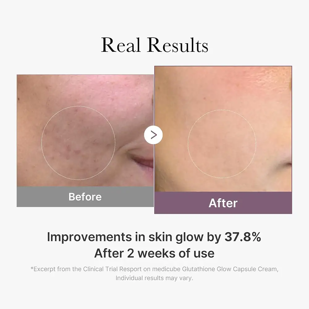 کرم کپسولی جوانساز و روشن‌کننده گلوتاتیون مدی کیوب اصل مدل Medicube AGE R Glutathione Glow Capsule Cream، کرم کره‌ای حاوی کپسول‌های گلوتاتیون، پپتید کلاژن و ترکیبات آبرسان برای کمک به شفافیت