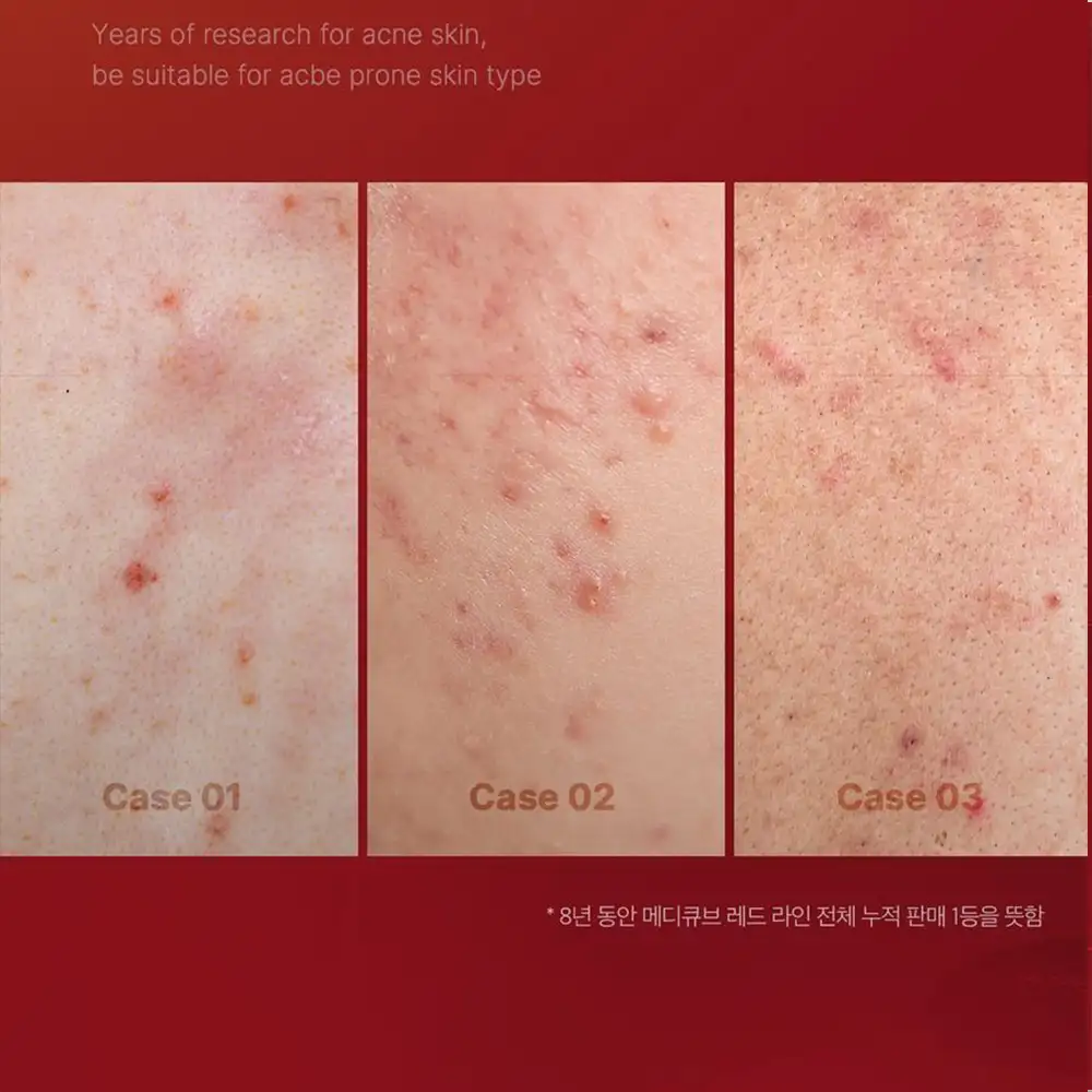 تونر ضد جوش و تسکین دهنده مدی کیوب اصل مدل Medicube Red Toner 2.0