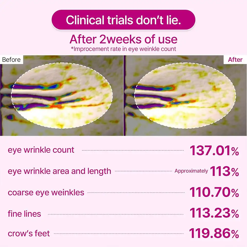 پچ زیر چشم کلسیم دکتر ملاکسین اصل مدل Cemenrete Calcium Volume Eye Patch ضد چروک روشن کننده و آبرسان
