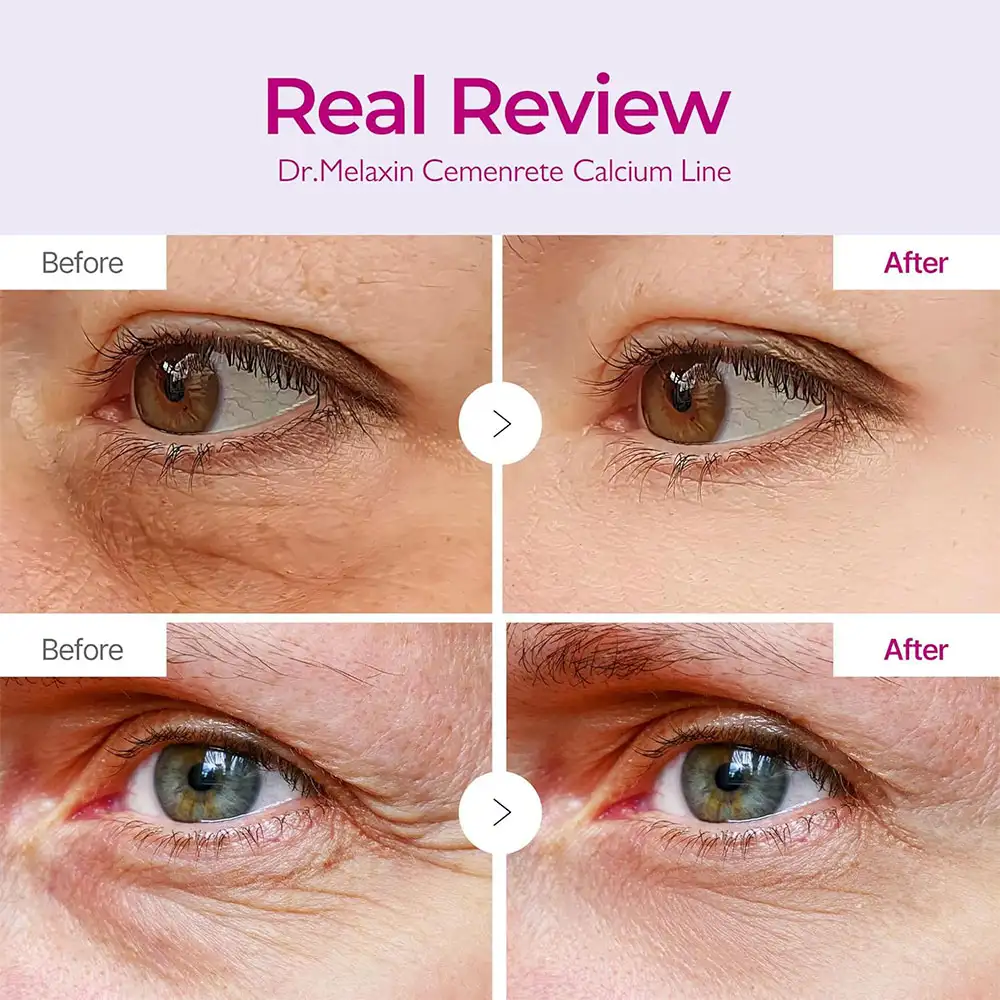 پچ زیر چشم کلسیم دکتر ملاکسین اصل مدل Cemenrete Calcium Volume Eye Patch ضد چروک روشن کننده و آبرسان