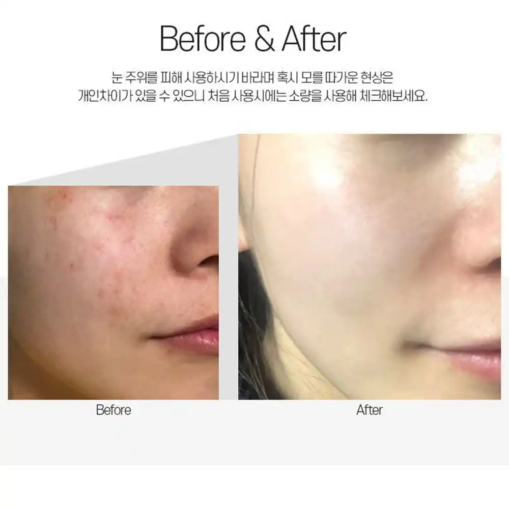 کرم تسکین دهنده و ترمیم کننده سنتلا مدی پیل Medi Peel Centella Mezzo Cream 30ml