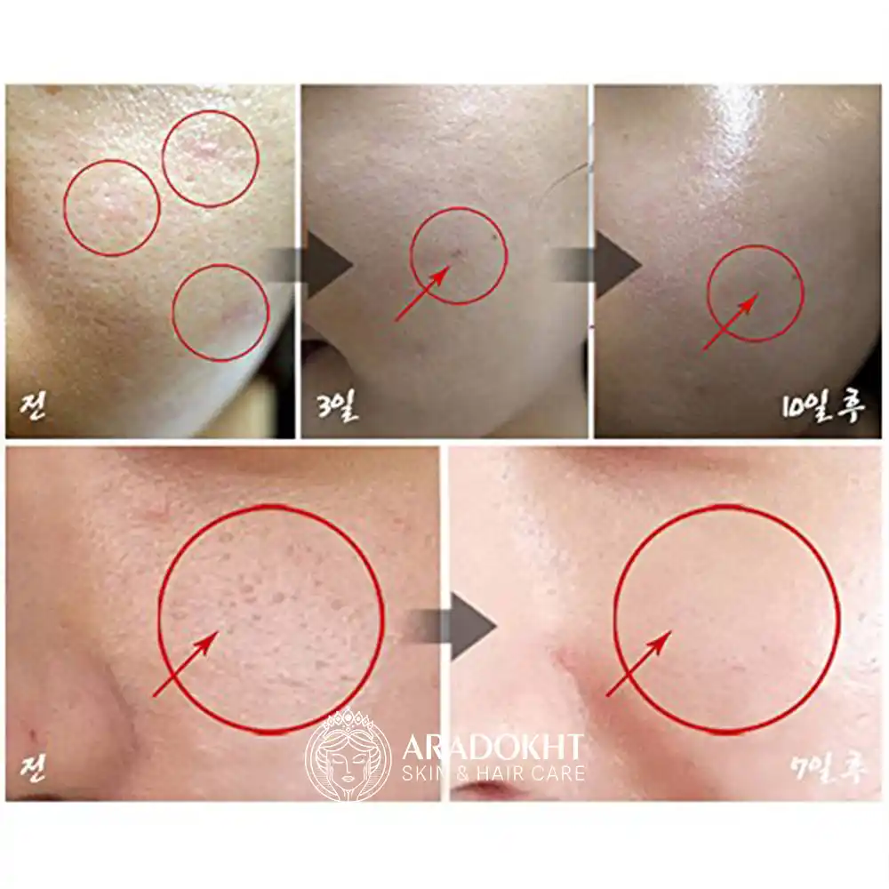 کرم تسکین دهنده و ترمیم کننده سنتلا مدی پیل Medi Peel Centella Mezzo Cream 30ml