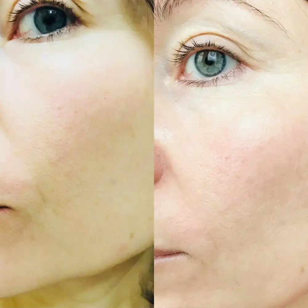 فوم ژل شستشوی صورت بایودرما سنسیبیو Bioderma Sensibio Gel Moussant برای پوست حساس و خشک