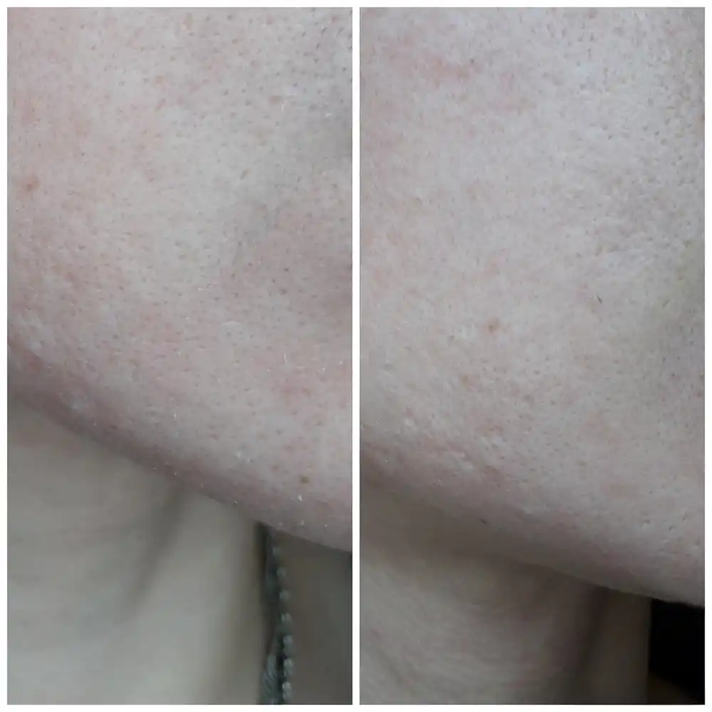 کرم مرطوب کننده و تغذیه کننده اتودرم بایودرما Bioderma Atoderm Cream Ultra برای پوست خشک و حساس