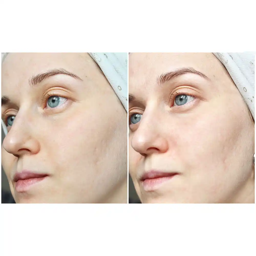 ژل شستشوی صورت سبیوم بایودرما Bioderma Sebium Gel Moussant برای پوست چرب و مختلط مستعد آکنه