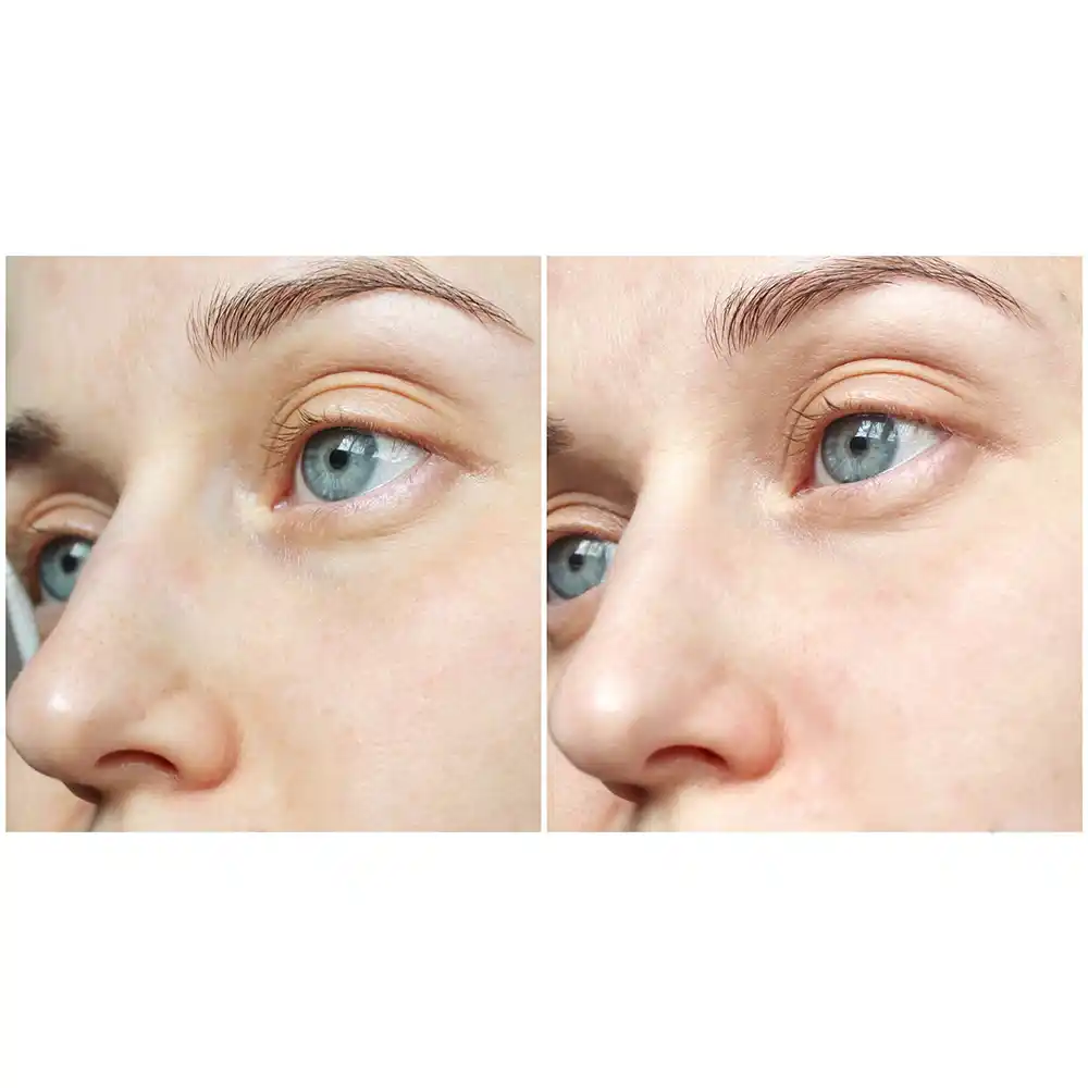 ژل شستشوی صورت سبیوم بایودرما Bioderma Sebium Gel Moussant برای پوست چرب و مختلط مستعد آکنه