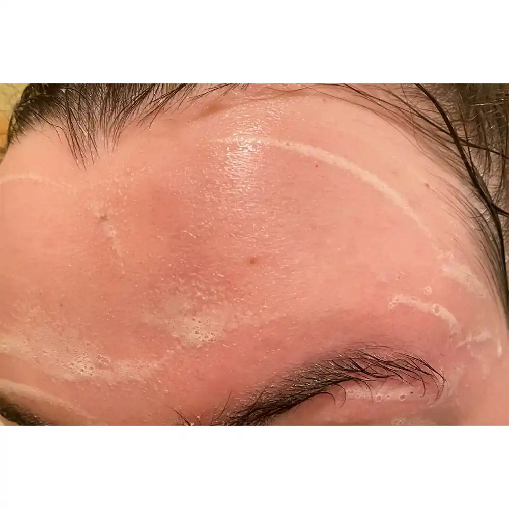 ژل شستشوی صورت سبیوم بایودرما Bioderma Sebium Gel Moussant برای پوست چرب و مختلط مستعد آکنه