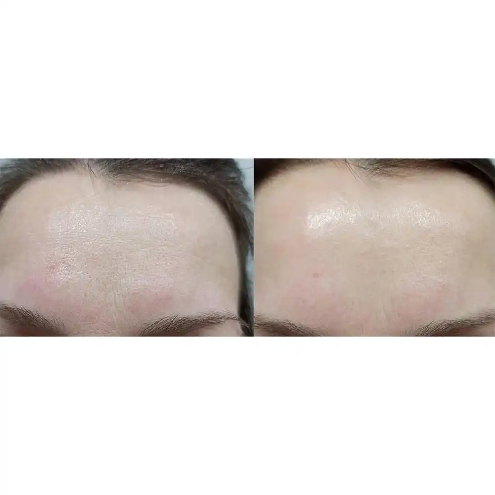 کرم مرطوب‌کننده چند منظوره امبریولیس Lait Creme Concentre 75ml فرانسوی
