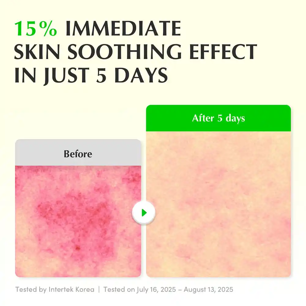 سرم ترمیم‌کننده و تسکین‌دهنده PDRN و آلوئه‌ورا اکوال بری EQQUALBERRY Aloe PDRN Calming Serum کره‌ای 30ml برای پوست حساس و آسیب‌دیده
