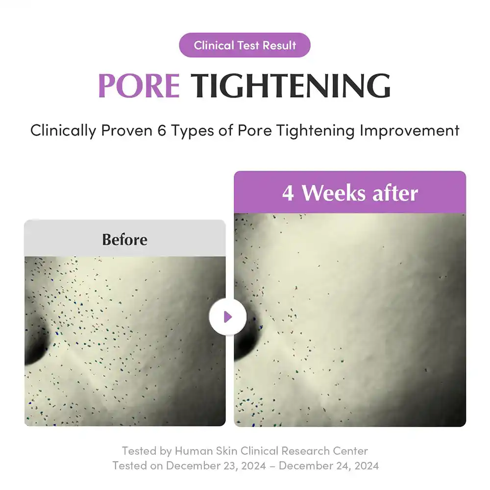 سرم کنترل منافذ PDRN بنفش اکوال بری EQQUALBERRY Purple PDRN Pore Minimizing Serum وگان کره‌ای برای بستن منافذ و کنترل چربی پوست