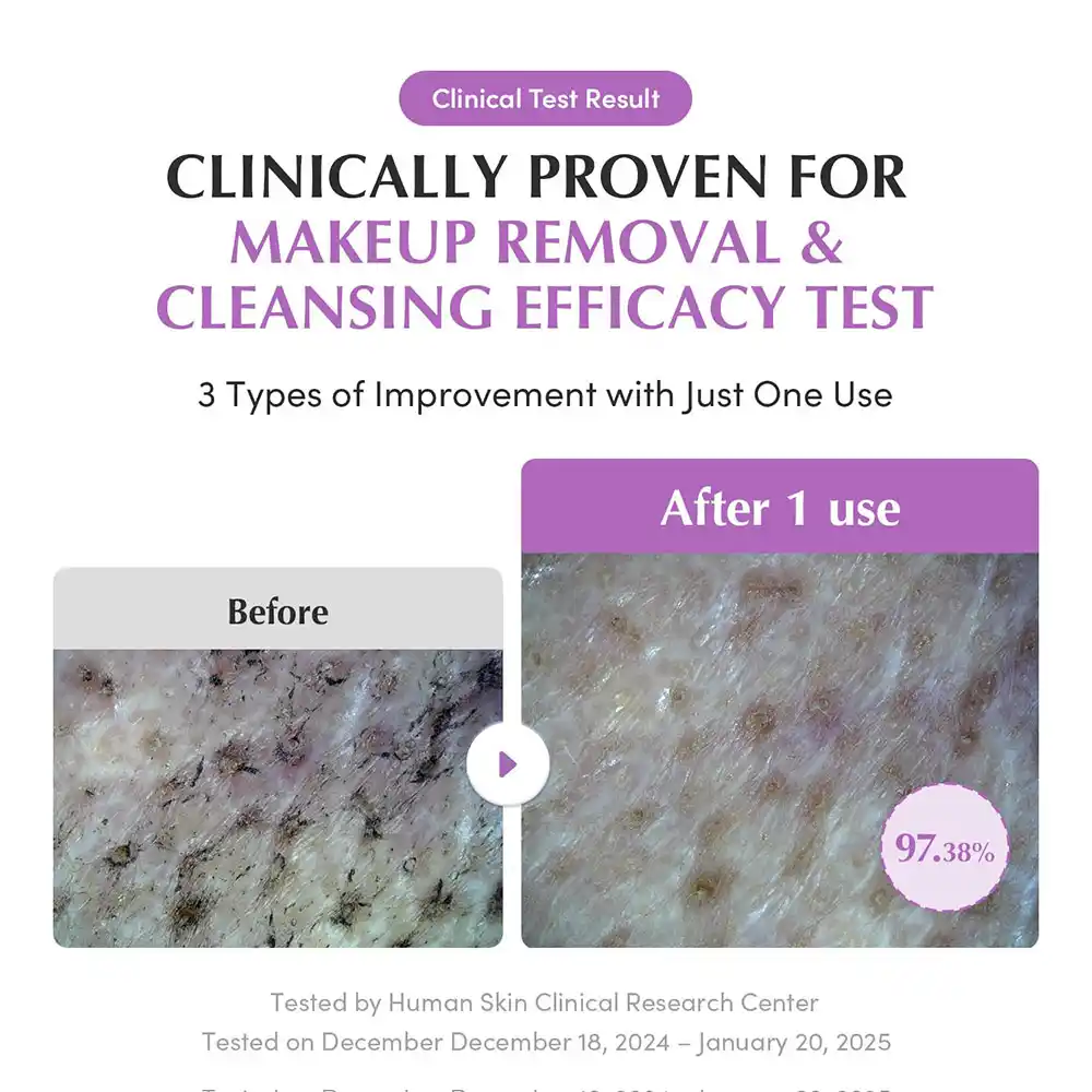 شوینده روغنی کنترل منافذ برنج بنفش اکوال بری EQQUALBERRY Purple Rice Pore Smoothing Cleansing Oil کره‌ای پاک‌کننده آرایش و بلک‌هد برای پوست حساس