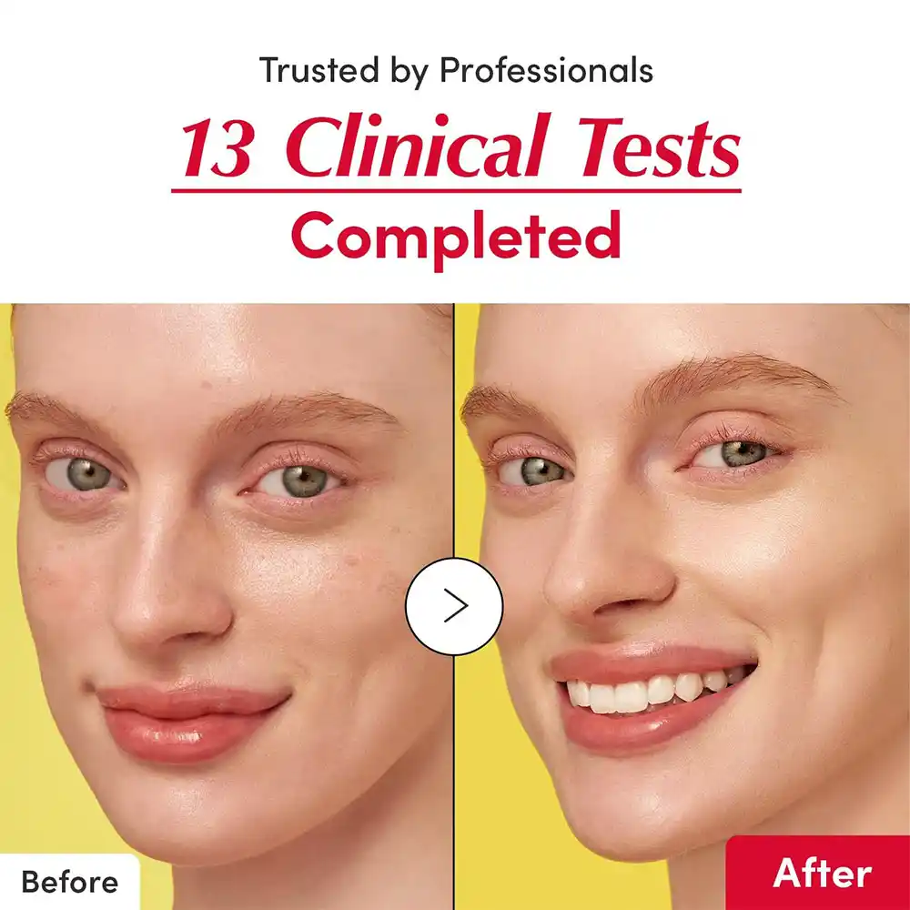 سرم ویتامین C آسرولا اکوال بری EQQUALBERRY Vitamin Illuminating Serum ضد لک و روشن‌کننده کره‌ای با نیاسینامید و سرامید