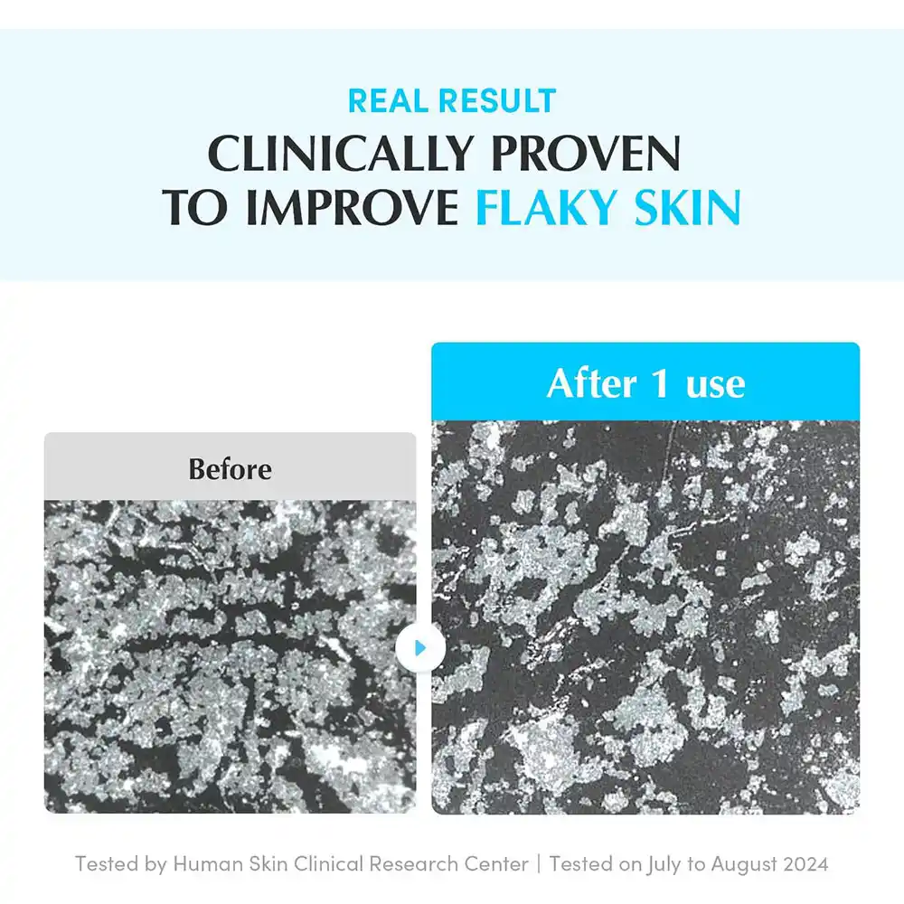 پد تونر آبرسان و تسکین‌دهنده اکوال بری EQQUALBERRY Swimming Pool Toner Pads کره‌ای دو طرفه با کمپلکس Hyal 8 و سیکا برای پوست حساس
