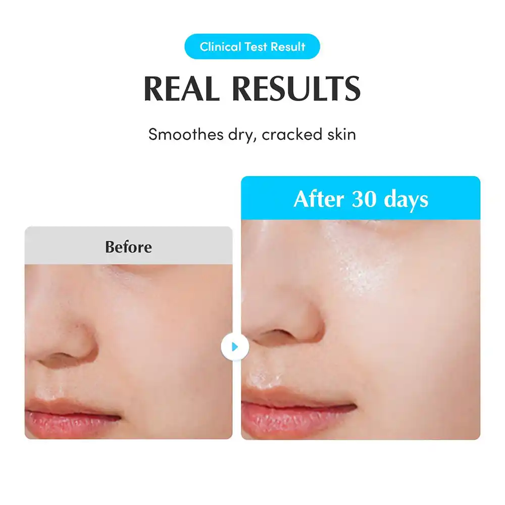آمپول آبرسان و تسکین‌دهنده اکوال بری EQQUALBERRY Swimming Pool Ampoule کره‌ای وگان با هیالورونیک اسید و فرمول 5 Cica برای پوست حساس