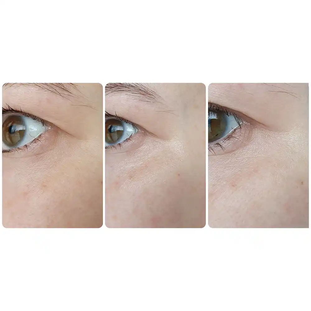 سرم ضد چروک و روشن‌کننده دور چشم رولی سرامید فارم استی Farmstay Ceramide Wrinkle Care Relaxing Rolling Eye Serum 25ml با اپلیکاتور سه توپی ماساژور حاوی نیاسینامید و سرامید