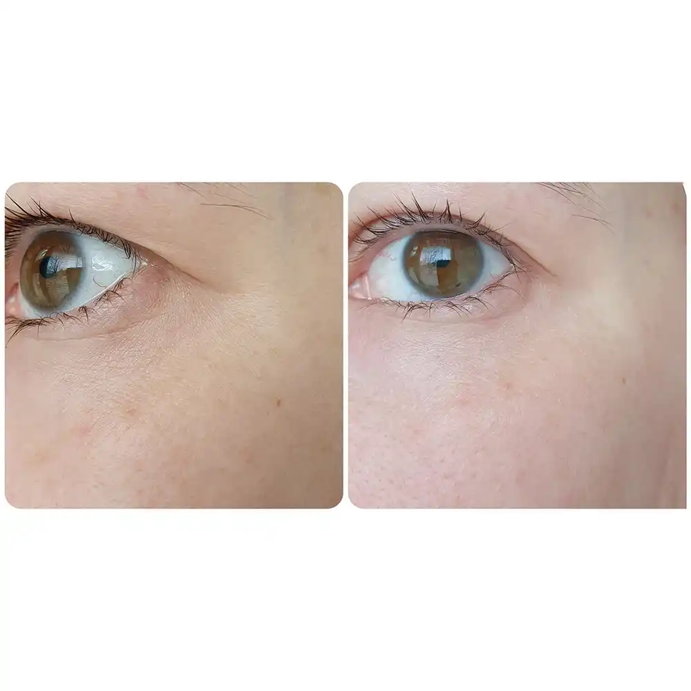سرم ضد چروک و روشن‌کننده دور چشم رولی سرامید فارم استی Farmstay Ceramide Wrinkle Care Relaxing Rolling Eye Serum 25ml با اپلیکاتور سه توپی ماساژور حاوی نیاسینامید و سرامید