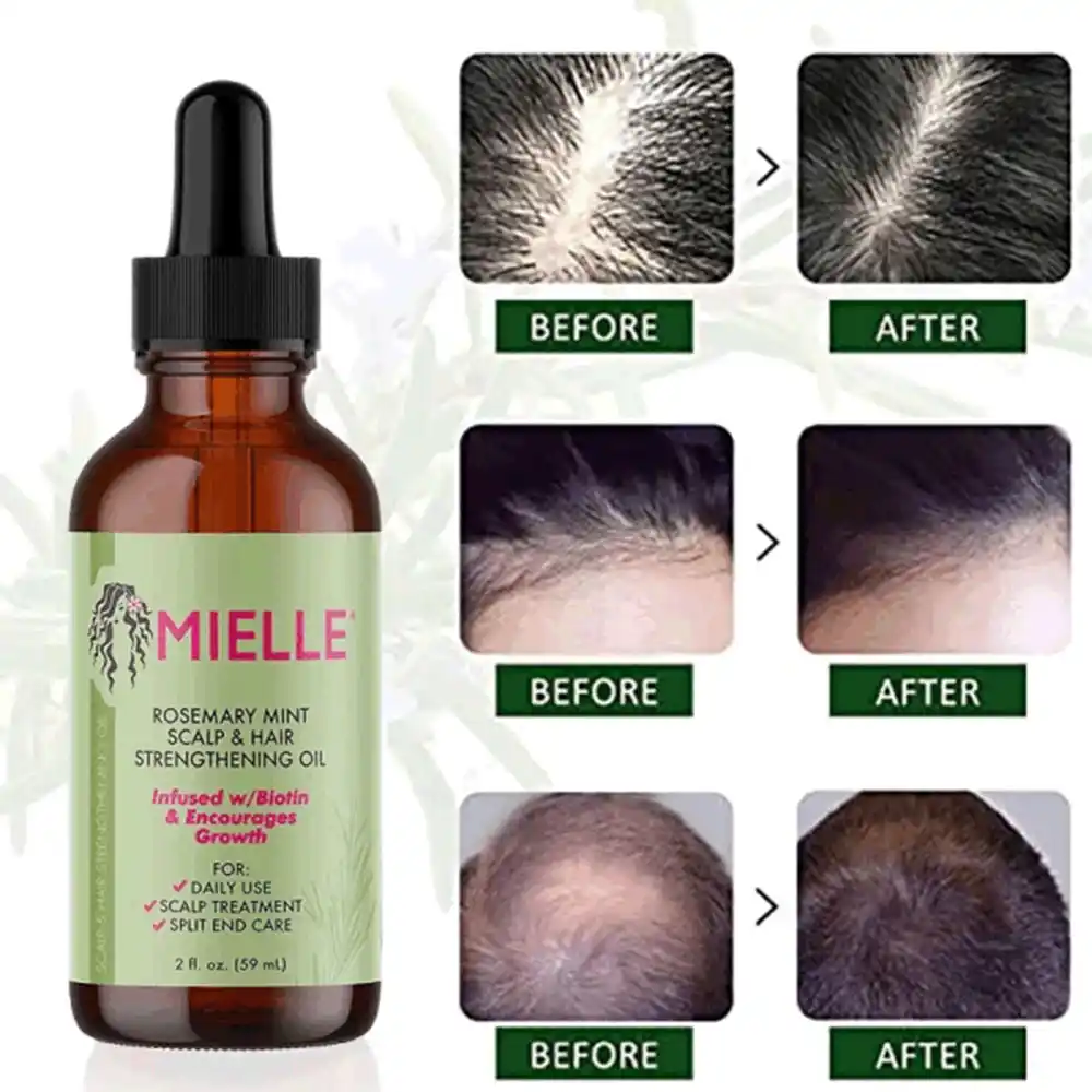 روغن ضد ریزش مو رزماری و نعناع میله ارگانیک Mielle Rosemary Mint Scalp Hair Oil حاوی بیوتین و روغن‌های اساسی برای تقویت مو و درمان پوست سر خشک