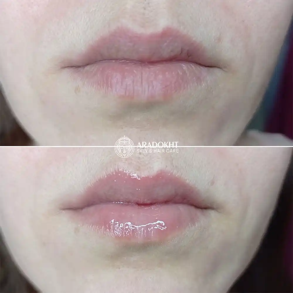 ماسک لب شب توت فرنگی لانیژ Laneige Lip Sleeping Mask EX Berry با ویتامین C، کره شی و کمپلکس توت برای آبرسانی، ترمیم و نرمی لب‌های خشک 20 گرم