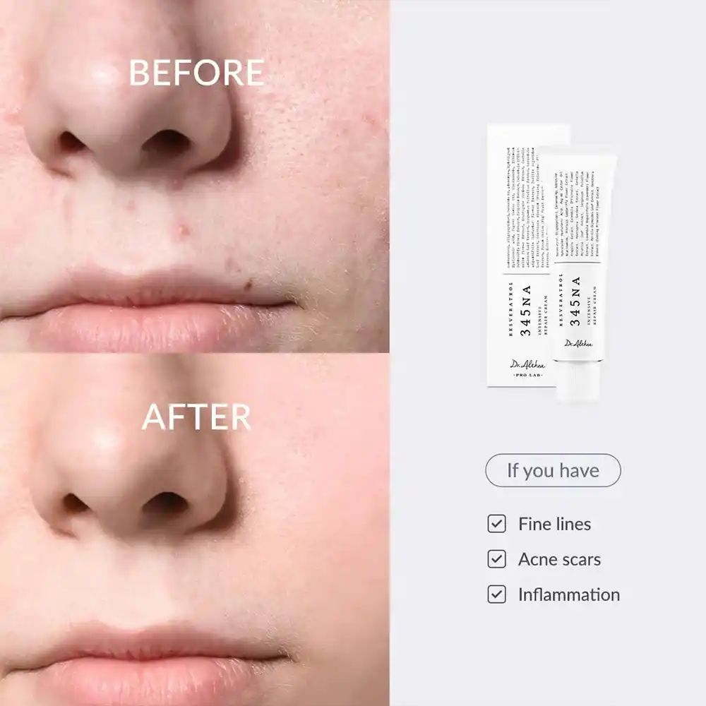 کرم مرطوب‌کننده و ضد لک Dr.Althea 345 Relief Cream