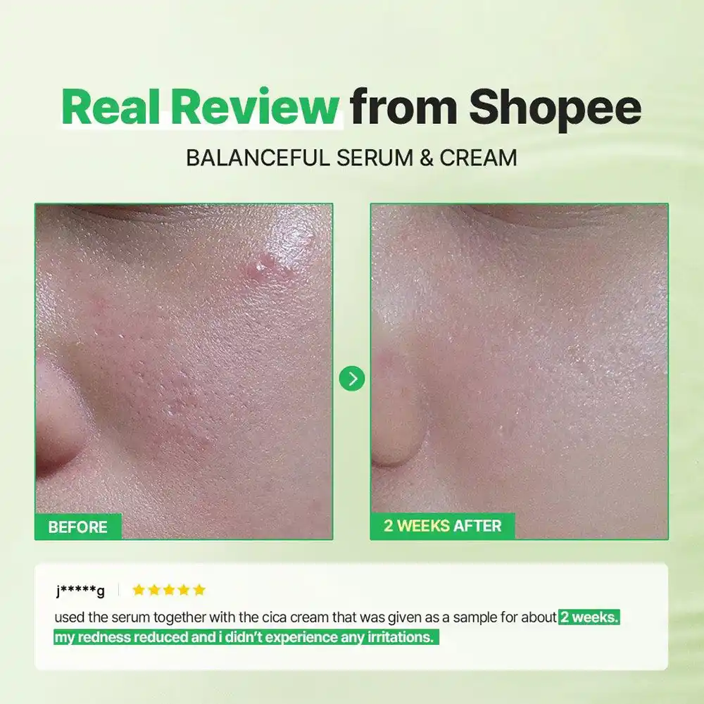سرم تسکین دهنده سیکا توریدن مخصوص پوست های حساس و مشکل دار Torriden Balanceful Cica Calming Se Copy (2)